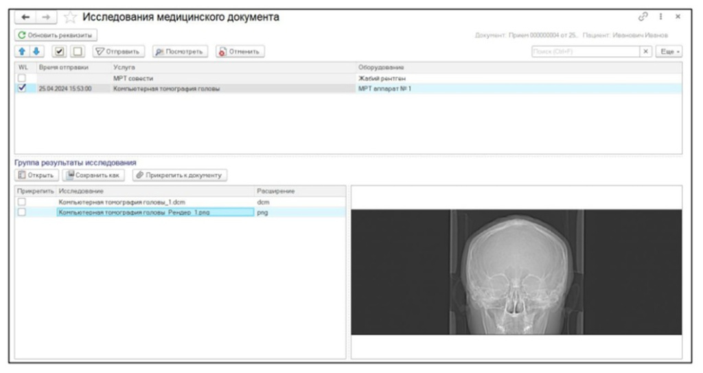 Программа для хранения и просмотра dicom файла 